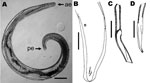 Thumbnail of Parasitic nematode isolated from the eye of the patient, a 29-year-old man from Brazil. A) Nematode that was removed from the iris, showing anterior (ae) and posterior (pe) extremities. Scale bar = 200 µm. B) Caudal region, subdorsal view, showing lateral alae, spicules, and the 2 postdeirids. Scale bar = 150 µm. C) Left spicule; D) right spicule. Scale bars = 20 µm.