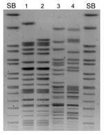 Thumbnail of Macrorestriction analysis (XbaI) by pulsed-field gel electrophoresis of Klebsiella pneumoniae N100469 (lane 1), K. pneumoniae N10–0506 (lane 2), Escherichia coli N10–0505 (lane 3), E. coli N10–0705 (lane 4), Salmonella enterica serovar Branderup molecular mass marker (XbaI) (lanes SB)..