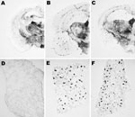 Thumbnail of Abnormal isoform of host-encoded prion protein (PrPSc) deposition patterns in brain and spleen from Tg110 mice infected with BSE-H. A–C) Paraffin-embedded tissue (PET) blots of representative coronal sections at the level of the hippocampus from Tg110 mice infected with atypical BSE-H (isolate 02-2695, first passage) showing either high-type (A) or classical-type protease-resistant prion protein (PrPres) phenotype (B). PET blot from Tg110 mice infected with BSE-C (C) is included for