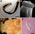 Thumbnail of A) Third-stage larva of the nematode Gnathostoma sp. Scale bar = 250 µm. B) Scanning electronic microscopy image depicting head bulb with 4 cephalic hooklet rows. Original magnification ×500. C) Gnathostoma sp. larvae in the flesh of their intermediate host, Eleotris picta fish. Original magnification ×4. Inset: Higher magnification of an encysted larva; original magnification ×100. Larvae photographs courtesy of Dr Diaz-Camacho, Universidad Autónoma de Sinaloa, Sinaloa, Mexico. D)