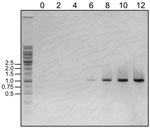 Thumbnail of Detection of increasing viral RNA by 1-step reverse transcription PCR in a novel arenavirus, Zambia, 2009. Viral RNA was extracted from 100 μL of culture supernatant on the indicated days (top) and eluted in 20 μL of distilled water. The RNA sample was subjected to 1-step reverse transcription PCR with the specific primers 5′-TGAGAGACATTGCTTCACAATTGACATCC-3′ and 5′-TGACCCATTCTTGATGTATTGTGACTCC-3′, which were designed to amplify a 1,000-bp fragment within the determined large gene se