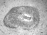 Thumbnail of Brainstem of a sow with vasculitis that was associated with ovine herpesvirus 2, showing edema, necrosis (fibrinoid necrosis), and infiltration of lymphocytes in the adventitia of the artery. Severe perivascular (Virchow-Robin space) lymphocytic cuffing was observed. Hematoxylin and eosin stain; scale bar = 50 μm.