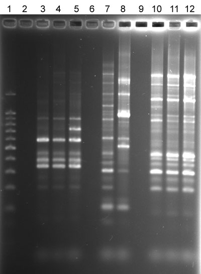 Repetitive sequence-based PCR fingerprint patterns of nontuberculous mycobacteria isolates from patients and household plumbing. Lane 1, 100-bp ladder; lane 2, no DNA control; lane 3, patient Mycobacterium avium isolate ML-P-1; lane 4, patient ML household M. avium shower water isolate ML-W-6–2; lane 5, patient ML household M. avium bathtub tap water isolate ML-W-8–3; lane 6, no sample; lane 7, patient M. avium isolate SC-P-3; lane 8, SC patient household M. avium water isolate SC-W-1-1; lane 9,