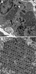 Thumbnail of Electron microscopic images of the cytopathic effect induced in MRC5 cells by a reovirus isolate from throat specimens of patient 2, a 22-month-old girl with acute necrotizing ancephalopathy. N, nucleus; arrows indicate viral intracytoplasmic inclusions. Scale bars indicate 2 µm (A) or 0.2 µm (B).