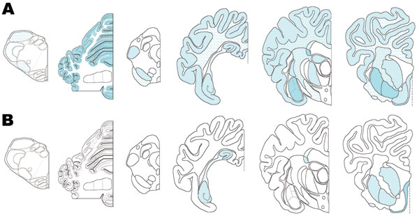 Distribution of immunolabeling in sheep infected with scrapie. A) animal 12, B) animal 11. Animal 12 exhibits the same distribution and type of immunolabeling as seen in natural disease (23). In animal 11, immunolabelling was much more restricted and did not involve the cerebellum.