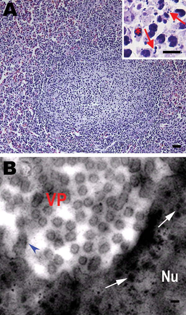 Histologic changes in the spleen of sick Chinese giant salamanders (Andrias davidianus), People’s Republic of China, 2010. Electron microscopy shows virus particles in splenocytes. A) Hyperplasia of lymphoid nodules in the splenic white pulp. Inset: Some splenocytes contain nuclear debris (arrows) and macrophages (asterisk). Hematoxylin and eosin stain; scale bars = 80 μm. B) Electron microscopy image of viral particles in splenocytes. Many viral particles are cytoplasmic and appear hexagonal or