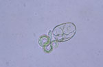 Thumbnail of Hatched nonviable Baylisascaris procyonis larvae demonstrating uptake of methylene blue. Original magnification ×40.