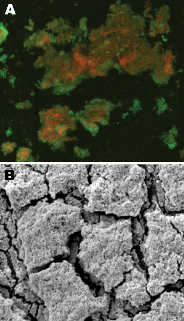 A) Confocal scanning laser microscopy image of central venous catheter tip in a patient with Nocardia nova complex central line–associated bloodstream infection. Bright green objects are viable biofilm bacteria, and orange-red objects are dead bacteria. Original magnification ×25. B) Scanning electron microscopy image of central venous catheter tip reveals biofilm surface structure. Original magnification ×5,000.