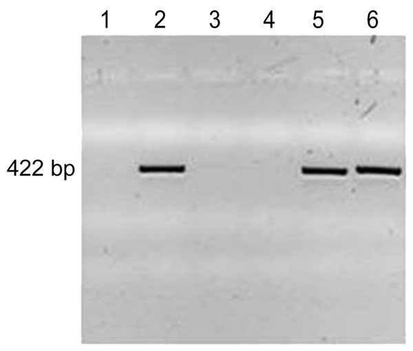 PCR amplification of Granulicatella adiacens DNA. DNA was prepared from the bacteria indicated, PCR-amplified with G. adiacens–specific primers, and subjected to agarose gel electrophoresis with ethidium bromide staining and ultraviolet light visualization. Lane 1, water, negative control; lane 2, G. adiacens–positive control, ATCC 49175; lane 3, DH5α Escherichia coli–negative control (Invitrogen, Carlsbad, CA, USA) 18263–012; lane 4, Enterobacter sakazakii–negative control, ATCC BAA-894 (Americ