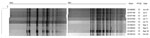 Thumbnail of Digestion pattern of ciprofloxacin-resistant Shigella sonnei isolated from 9 patients for XbaI and BlnI, Montréal, Québec, Canada, June–October 2010. PFGE, pulsed-field gel electrophoresis.