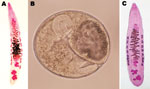 Thumbnail of A) Adult Opisthorchis viverrini liver fluke (length 12.0 mm) isolated from a human after chemotherapy and purgation in Takeo Province, Cambodia, showing the characteristic morphology of the two 4–5-lobulated testes. B) Metacercaria of O. viverrini fluke (diameter 0.22 mm) detected in a freshwater fish (Puntioplites proctozysron). C) Young adult O. viverrini fluke (length 5.5 mm) isolated 6 weeks after experimental infection of a hamster with metacercariae from P. proctozysron fish.