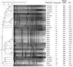 Thumbnail of Characteristics of isolates obtained from patients with Clostridium difficile infection, Maryland and Connecticut, USA, May 2002–July 2007. PFGE, pulsed-field gel electrophoresis.