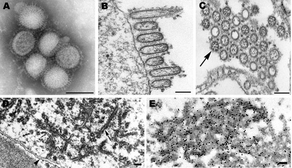 Electron microscopy of pandemic (H1N1) 2009 virus. A) Negatively stained virions grown in MDCK cells showing spherical particles with distinct surface projections. Scale bar = 100 nm. B) Filamentous and ovoid particles assembling at the plasma membrane. Scale bar = 100 nm. C) Extracellular particles showing internal nucleocapsids, seen in cross-section, surrounded by an envelope with prominent spikes. Note all 8 nucleocapsids present in 1 virion (arrow). Scale bar = 100 nm. D) Dense tubules (arr