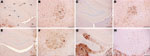 Thumbnail of Immunohistochemical analysis of brains of host-encoded prion protein (PrP)-a mice (RIII) inoculated with (A and B) fixed material from the goat with suspected bovine spongiform encephalopathy (BSE), (C and D) fixed material from experimental goat BSE, (E and F) unfixed material from experimental sheep BSE, and (G and H) fixed material from experimental goat scrapie. No PrPSc was detected in the molecular layer of the dentate gyrus in the suspected case (A) and the BSE controls (C an