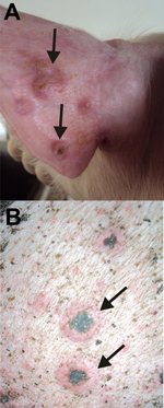 Thumbnail of Lesions caused by swinepox virus, Brazil, 2011. A) Ear of a piglet in the nursery unit. Arrows indicate vesicles filled with pustular fluid. B) Trunk of a pig in the finishing unit. Arrows indicate umbilicated red lesions with black scabs in the center.