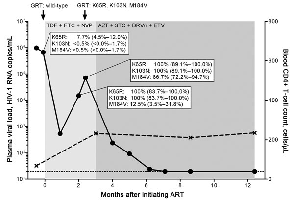 Kinetics of viremia, CD4+ T-cell count, and drug resistance mutations in a treatment-naive person from Eritrea, infected with HIV-1 subtype C, who was experiencing early antiretroviral therapy (ART) failure. Viral load (circles) was measured by using the Cobas AmpliPrep TaqMan HIV-1 test version 2.0 (Roche Diagnostics, Rotkreuz, Switzerland) with a detection limit of 20 HIV-1 RNA copies/mL plasma (dotted line). CD4+ T-cell count is depicted in crosses. Genotypic resistance testing (GRT) based on