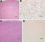 Thumbnail of Histopathologic analysis of squirrel monkey inoculated with bovine spongiform encephalopathy agent (A, B). Spongiform degeneration in the cerebral cortex (A), adjacent section showing abundant prion protein (PrP) immunopositivity (B). Squirrel monkey without transmissible spongiform encephalopathy (C, D). Cerebral cortex with no spongiform degeneration (C), absence of PrP positivity in the cerebral cortex (D). Panels A and C correspond to sections stained with hematoxylin and eosin;