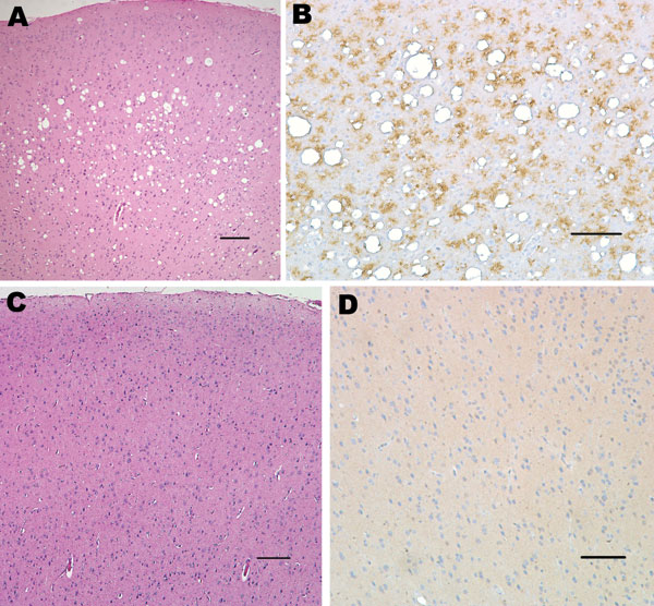 Histopathologic analysis of squirrel monkey inoculated with bovine spongiform encephalopathy agent (A, B). Spongiform degeneration in the cerebral cortex (A), adjacent section showing abundant prion protein (PrP) immunopositivity (B). Squirrel monkey without transmissible spongiform encephalopathy (C, D). Cerebral cortex with no spongiform degeneration (C), absence of PrP positivity in the cerebral cortex (D). Panels A and C correspond to sections stained with hematoxylin and eosin; panels B and
