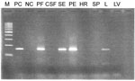 Thumbnail of PCR product of postmortem samples RP381/11 on 3% agarose gel in study of human adenovirus type 7 outbreak in a police training center, Malaysia, 2011. M, 100-bp ladder; PC, positive control; NC, negative control; PF, pericardial fluid; CSF, cerebrospinal fluid; SR, serum; PE, pleural effusion; HR, heart; SP, spleen; L, lung tissue, LV, liver.