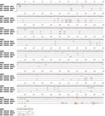 Thumbnail of Newly identified lpxL1 mutations XV, XVI, and XVII. lpxL1 sequence data from isolates harboring each of the corresponding meningococcal capsular group Y mutations (in parentheses), England and Wales. Mutations are aligned with the full-length gene from strain MC58. All of the alleles share a common start codon (green arrow). Mutations and stop codons are denoted by red circles and red lines, respectively. Mutation XVI is a single-base deletion at nt A4 that causes a frame shift resu