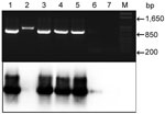 Thumbnail of Top, agarose gel electrophoresis of nested PCR products of human fecal samples amplified with primers (pairs DW2-F + DW2-R and CYTB1-F + CYTB2-R) and stained with ethidium bromide. Bottom, autoradiograph of a Southern blot of the same gel. α-32P-ATP–labeled acytochrome B gene of Plasmodium falciparum was used as a probe. Lanes 1–6, samples from humans with malaria (the infection sample in lane 6 is weak); lane 2, spurious amplicon; lane 7, sample from an uninfected person; lane M, 1