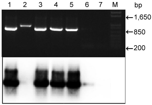 Top, agarose gel electrophoresis of nested PCR products of human fecal samples amplified with primers (pairs DW2-F + DW2-R and CYTB1-F + CYTB2-R) and stained with ethidium bromide. Bottom, autoradiograph of a Southern blot of the same gel. α-32P-ATP–labeled acytochrome B gene of Plasmodium falciparum was used as a probe. Lanes 1–6, samples from humans with malaria (the infection sample in lane 6 is weak); lane 2, spurious amplicon; lane 7, sample from an uninfected person; lane M, 1-kb molecular