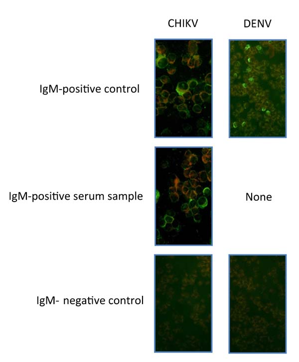 Images of immunofluorescence assays in Vero E6 cells for IgM against chikungunya virus (CHIKV) and dengue virus (DENV). For each of the viruses, a positive control, an example of a positive serum sample (if available), and a negative control are shown. Original magnification ×200.