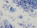 Thumbnail of Dientamoeba fragilis trophozoites in a smear of pig feces after Giemsa staining, Italy, 2010–2011. Scale bar = 10 μm.