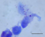 Thumbnail of Rickettsia sp. AvBat in XTC-2 cell culture with Gimenez staining. Scale bar = 20 μm. 