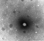 Thumbnail of Electron micrograph of orthoreovirus HK50842/10. Scale bar = 200 nm.