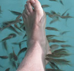 Thumbnail of Doctor fish surrounding foot during ichthyotherapy.