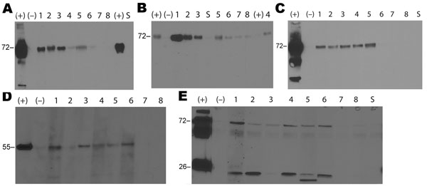 Results of Western blot analyses of pooled serum samples from adult guinea pigs in Ecuador. The guinea pigs were obtained from farms in Cuenca, where they had been raised as livestock, or from live animal markets in Guayaquil and Manabí. The results show different influenza antigens: recombinant hemagglutinin (rHA) A/New Caledonia/20/1999 (A); rHA A/Wisconsin/67/2005 (B); rHA A/Vietnam/1203/2004 (C); recombinant nucleoprotein A/Puerto Rico/08/1934 (D); and B virus (whole virus B/Yamagata/16/1988