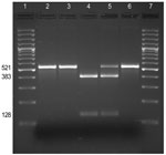Thumbnail of Screening for the A2047G mutation by PCR–restriction fragment length polymorphism analysis. The 521-bp fragment of the 23S rDNA gene amplified by PCR from the Bordetalla pertussis clinical isolates (FR4229, FR4930, and FR4991) and controls (A228 and Tohama I) was digested with the endonuclease BbsI. Lanes 1 and 7, M, 100-bp ladder (SM0321; Fermentas, St. Leon-Rot, Germany); lane 2, B. pertussis FR4929; lane 3, B. pertussis FR4930; lane 4, B. pertussis FR4991; lane 5, control B. pert