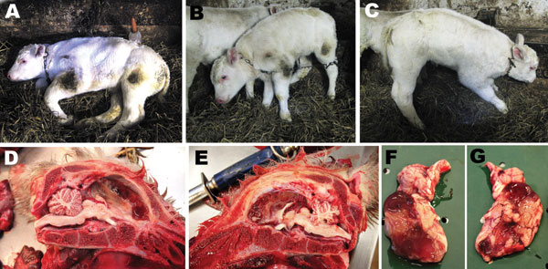 A 7-day old, female, Schmallenberg virus–positive calf showing severe central nervous system dysfunctions (A–C) and lesions (D–E). A) Spontaneously lying down; B–C) standing with assistance; D–G) hydranencephaly, either with the encephalon in place (D–E) or extracted (F–G). The cerebral hemispheres were replaced by 2 thin-walled, fluid-filled cysts (diamonds) with some floating islets and peninsulae corresponding to preserved cortex (stars). The cerebrum was variably preserved, the occipital lob