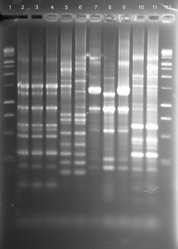 rep-PCR fingerprint patterns of patient and household isolates, New York, New York, USA, 2001-2011. Lane 1, 100-bp ladder; lane 2, patient no. 5 Mycobacterium avium isolate AG-P-1; lane 3, patient no. 5 household filter M. avium isolate AG-F-2–0-2; lane 4, patient no. 5 household filter M. avium isolate AG-F-2-I-1; lane 5, patient no. 6 M. abscessus-chelonae complex (MAC-X) isolate GG-P-1; lane 6, patient no. 6 household swab M. chimaera isolate GG-Sw-9–1; lane 7, patient no. 8 M. avium isolate 