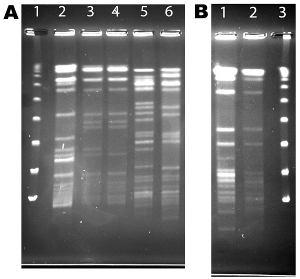 Pulsed field gel electrophoresis (PFGE) of AseI digest patterns of patient and household isolates, New York, New York, USA, 2001–2011. A) Patient and household isolates. Lane 1, λ ladder; lane 2, patient no. 5 Mycobacterium avium isolate AG-P-1; lane 3, patient no. 5 household filter M. avium isolate AG-F-2–0-2; lane 4, patient no. 5 household filter M. avium isolate AG-F-2-I-1(environmental isolates in lanes 3 and 4 are indistinguishable; patient isolate in lane 2 considered clonal with 2 envir