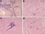 Thumbnail of Nonsuppurative encephalitis in goat affected by louping ill. A) Cerebellum with necrosis of Purkinje cells. Hematoxylin and eosin (H&amp;E) stain; scale bar = 100 µm. Inset: necrosis of Purkinje cells. H&amp;E stain; scale bar = 20 µm. B) Midbrain. Area of neurophagia (arrow) surrounded by microglial cells. Necrosis of neurons can be also seen. H&amp;E stain; scale bar = 50 µm. C) Lymphoid perivascular cuff in midbrain. H&amp;E stain; scale bar = 50 µm. D) Spinal cord, gray matter. 