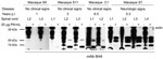 Thumbnail of Western blot analysis of bovine spongiform encephalopathy proteinease-resistant prion protein (PrPres) (lumbar spinal cord segments) in preclinical and clinically ill macaques. An atypical PrPres pattern was detectable in macaques euthanized during incubation from 3 years p.i. (macaque S11) to 6.5 years p.i. (macaque C1). All samples were co-stained with an anti-actin-antiserum. p.i., postinoculation; PK, proteinase K; mAb, monoclonal antibody. 