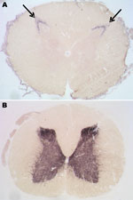 Thumbnail of Paraffin-embedded tissue blot analyses of lumbar spinal cord segments from the preclinical macaque S14 (A) and a clinically ill macaque (B) for detection and localization of proteinease-resistant prion protein (PrPres) ) deposits. These deposits could be detected in the substantia gelatinosa (arrows) of preclinical cases. 