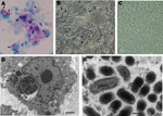 Thumbnail of Vero cells inoculated with Amblyomma tick extracts for isolation of rickettsiae. A) Rickettsiae-like organisms stained in red by Gimenez staining (original magnification ×400). B) Inoculated monolayer photographed under phase-contrast microscopy (original magnification ×400). C) Uninfected control monolayer under phase-contrast microscopy (original magnification ×400). D) Transmission electron microscopy of infected cells. E) Transmission electron microscopy image of intravacuolar b