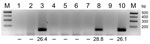 Thumbnail of RNA extracted from pools of Culicoides obsoletus group midges was tested in 1-step reverse transcription quantitative PCRs (RT-qPCRs) for the Schmallenberg virus L segment, and the products were analyzed by agarose gel electrophoresis. Lanes 1–8, C. obsoletus group midge pools 1–8; lanes 9–10; negative and positive controls, respectively. Numbers below lanes are cycle threshold values from RT-qPCRs; –, no value. M, size marker. Amplicons (145 bp) from positive pools were extracted a