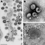 Thumbnail of A) Transmission electron micrograph of an ultrathin section of Vero cells infected with Cygnet River virus (CyRV) from a Muscovy duck, Australia. Arrow, virus budding from the plasma membrane; arrowhead, sand-like structures. *Host cell projection. Scale bar = 200 nm. B and C) Transmission electron micrographs of CyRV prepared by negative-contrast electron microscopy. Scale bars = 100 nm. Preparations were derived from supernatant of CyRV-infected Vero cells (B) and from allantoic f