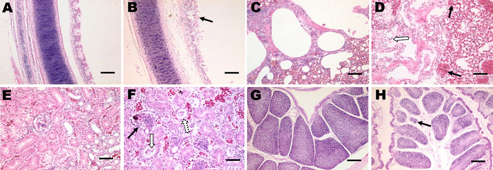 Histopathologic analysis (hematoxylin and eosin stain) of tissues from 30-day-old chickens infected with infectious bronchitis virus YN strain. B) Trachea, extensive dropout, degeneration, and necrosis of the ciliated epithelial cells (black arrow). Scale bar = 100 μm. D) Lung tissue with hemorrhage (black arrow), congestion, and lymphocytic infiltration in alveolar lumen (white arrow). Scale bar = 50 μm. F) Kidney tissue with severe renal lesions, including degeneration (white arrow), and necro