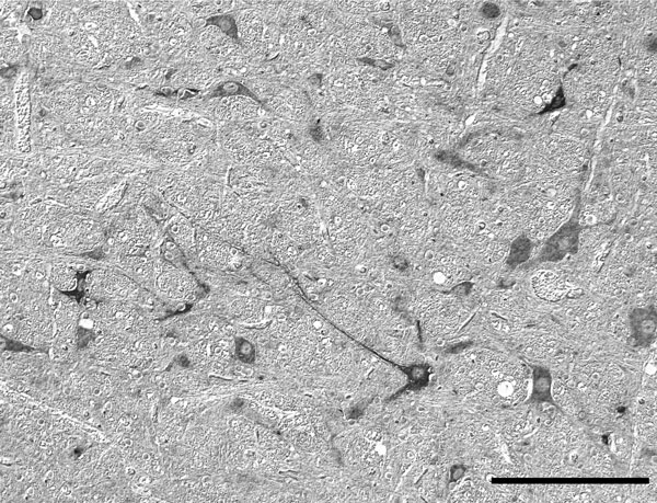 In situ detection by using Nomarski differential interference contrast microscopy of Schmallenberg virus mRNA in neurons in the medulla of a neonatal sheep for which Schmallenberg virus infection was confirmed by real-time quantitative reverse transcription PCR. Scale bar = 100 μm.