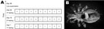 Thumbnail of Monitoring surveillance of Bartonella quintana infection in macaques and identification of lice. A) Macaques were housed in linked cages (squares); dashed lines indicate wired net enabling direct contact between macaques, and solid line indicates wall that does not enable contact between macaques. +, positive result for PCR; –, negative result for PCR. B) Stereomicroscope image of a Pedicinus obtusus louse, a macaque-specific ectoparasite characterized by a slender body ≈1.0–3.0 × 0