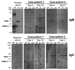 Thumbnail of Western blot analyses, using recombinant P44-1 protein (rP44-1) and Anaplasma phagocytophilum–infected THP-1 cells as antigens, of serum samples from 2 men, case-patients 1 and 2, who had A. phagocytophilum infection, Kochi Prefecture, Japan. The Escherichia coli, which produced rP44-1, was kindly provided by Yasuko Rikihisa (Ohio State University, Columbus, OH, USA). The rP44-1 and the rabbit hyperimmune serum (positive control serum) were prepared as described (11,12). Results for