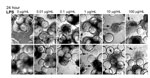 Thumbnail of Lipopolysaccharide (LPS) induces morphologic changes consistent with cytopathic effects in Norwalk virus–inoculated 3-dimensional INT-407 aggregates. Two independent sets of light microscopy images show 3-D intestinal aggregates treated with increasing concentrations of LPS for 24 h. Arrows indicate cells (or cellular debris) that were released from the support beads. Original magnification ×20.