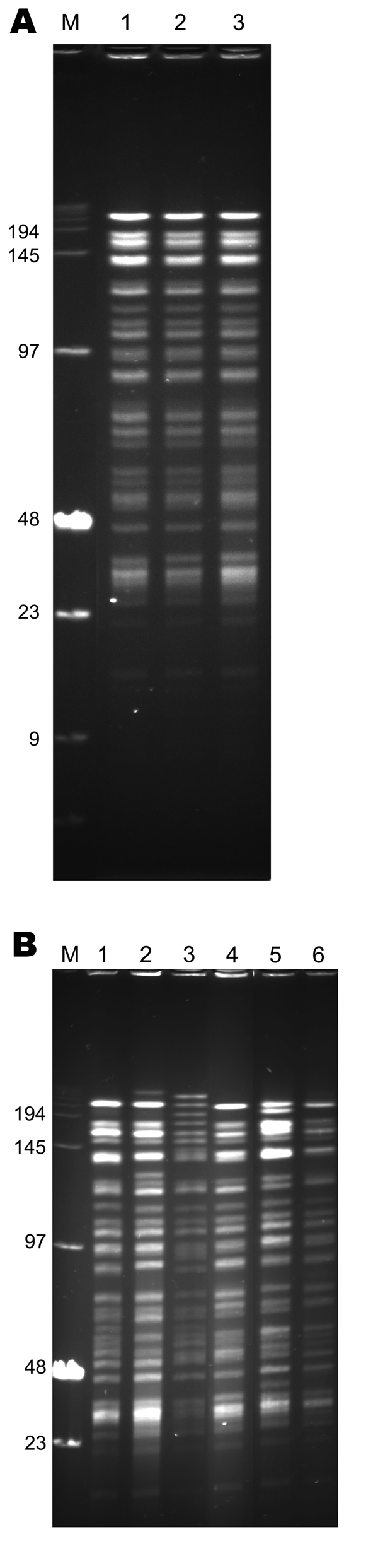 NotI pulsed-field gel electrophoresis patterns of Yersinia pestis strains of biovar Medievalis obtained during plague outbreak in Libya, 2009. A) Pattern of three 2009 isolates from Libya. Lane M, low-range DNA marker (New England Biolabs, Ipswich, MA, USA); lane 1, IP1973; lane 2, IP1974; lane 3, IP1975. B) Comparison of the pattern of 1 isolate from Libya with those of other biovar Medievalis strains. Lane M, low-range DNA marker (New England Biolabs); lane 1, IP516 (Kurdistan); lane 2, IP519 
