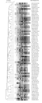 Thumbnail of NotI restriction patterns of genomic DNA of representative Vibrio cholerae non-O1, non-O139 strains, Kolkata, India. Dendrogram was generated by using the unweighted pair group with arithmetic mean method.