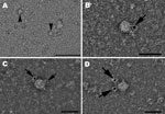 Thumbnail of Hepatitis E virus (HEV) particles in the cell culture supernatant of pork liver sausage sample A, collected at 33 dpi. A) Transmission electron micrograph of negatively stained HEV particles ≈33 and 34 nm (arrowheads). Scale bar indicates 200 nm. B–D) Hepatitis E virions ≈28 (B), 33 (C), or 32 (D) nm in diameter, identified by using an HEV genotype 3–specific rabbit hyperimmune serum and a gold-labeled secondary antibody. Arrows show bound gold particles. Scale bars indicate 50 nm.